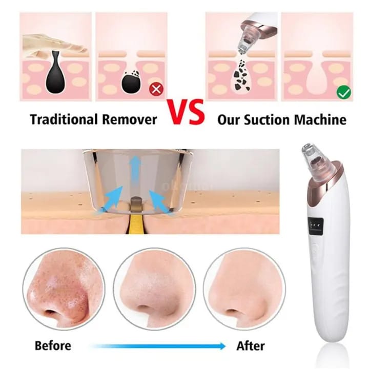 0232d2aff2586178ea8b72fc2f857691 Face Vacuum Suction Blackhead Remover Pore Cleaner Electric Deep Cleansing Tool For Nose And Face - Image 4