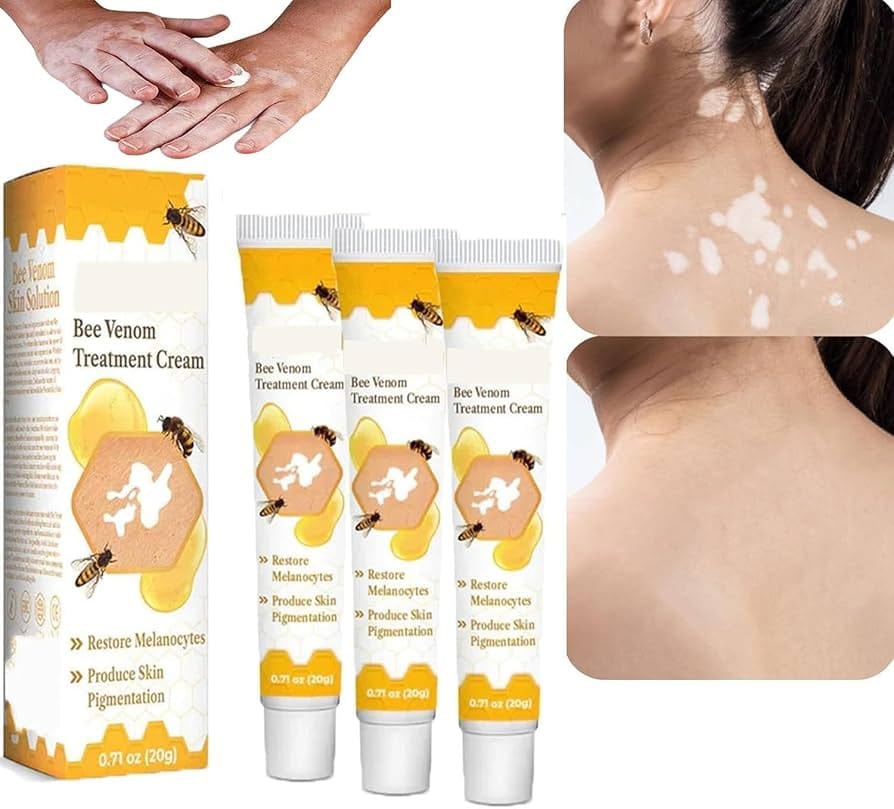 1651e7d1475965e14624f845dc815d36 Fivfivgo™ VitiGO Bee Venom Correcting Cream (20g) – Advanced Melanocyte Support for Skin Pigmentation Recovery and Even