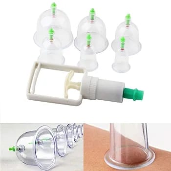 31b1aec3c55b5f61c40a7bb61f3f48bc 10-Piece Hijama Cupping Therapy Set – Vacuum Suction Massage Cups with Pull-Out Pump | Pain Relief, Blood Circulation, R - Image 3