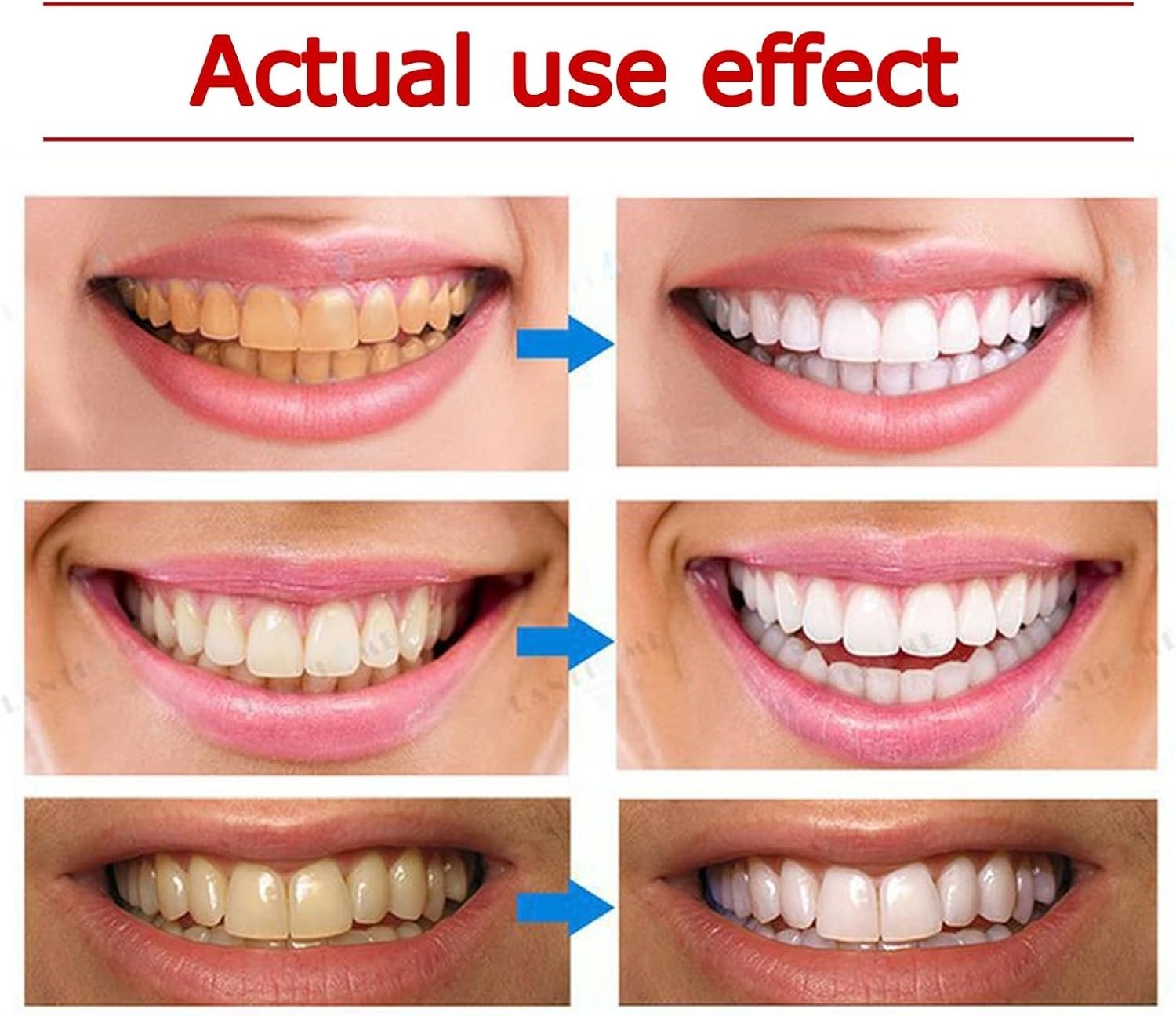 32eb56a410076cba7a599690cd8ef63c Yayashi SP-4 Ultra Whitening Toothpaste – 150ml Probiotic Stain Remover for Bright, Healthy Teeth - Image 5