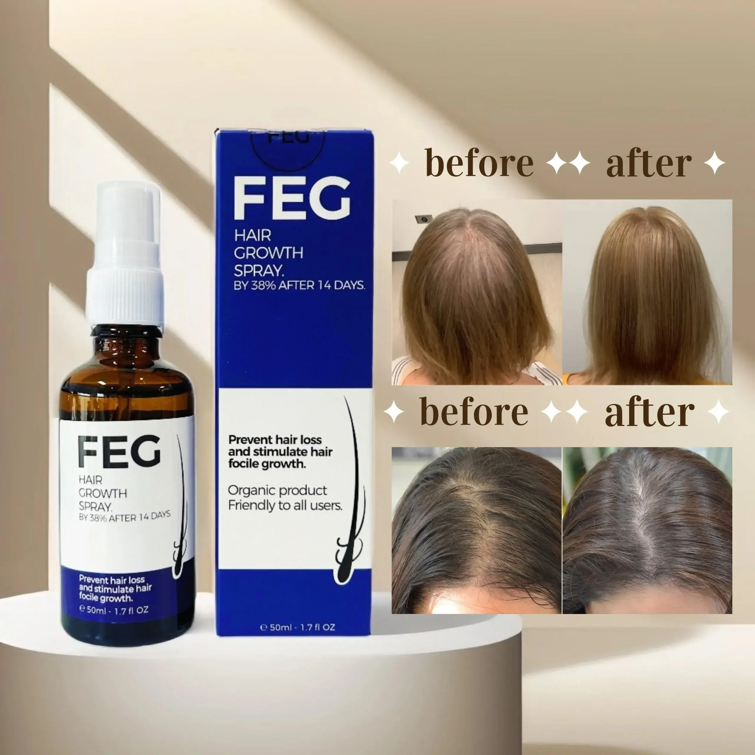 397040a2012408b60357af1972bc3a64 FEG PLUS Hair & Beard Regrowth Spray – Anti Hair Loss Formula with Minoxidil, Redensyl & Natural Extracts (50ml)