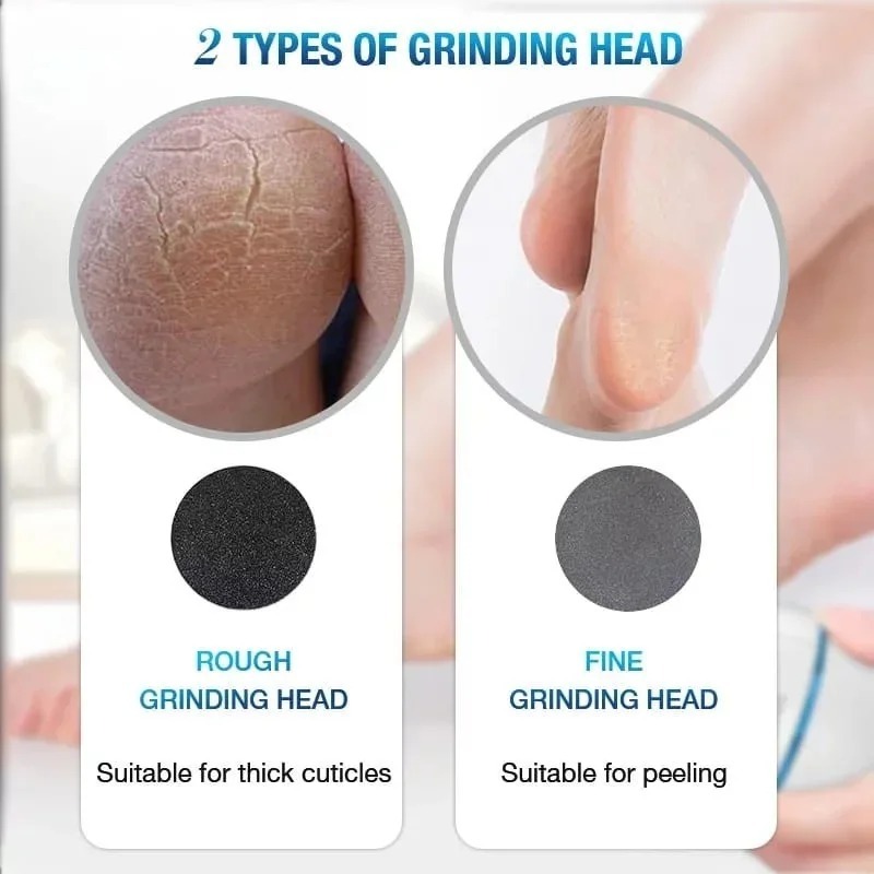 WhatsApp-Image-2025-09-04-at-1.56.24-PM Back Callus Remover with Built-In Vacuum – Electric Foot Grinder for Dead Skin, Cracked Heels & Calluses, Rechargeab - Image 3