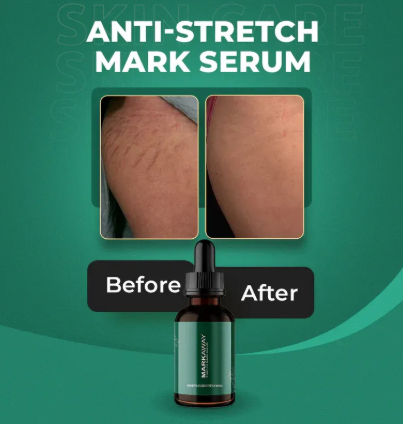 b0a6405c5c02fa1ebbb352704e5291a5 Markaway Advanced Stretch Mark Serum – Clinic-Tested Formula for Prevention & Fading | Retinol, Hydroquinone, & AHA/BHA- - Image 3