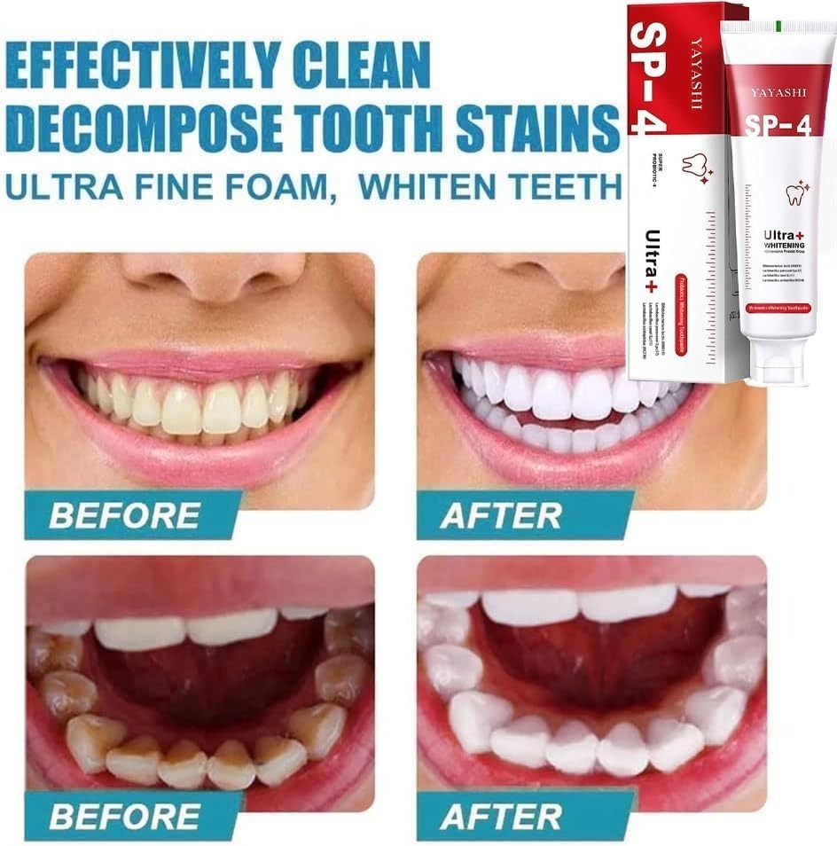 c5ba1e25659a2115dcd717a2d977951c Yayashi SP-4 Ultra Whitening Toothpaste – 150ml Probiotic Stain Remover for Bright, Healthy Teeth - Image 4