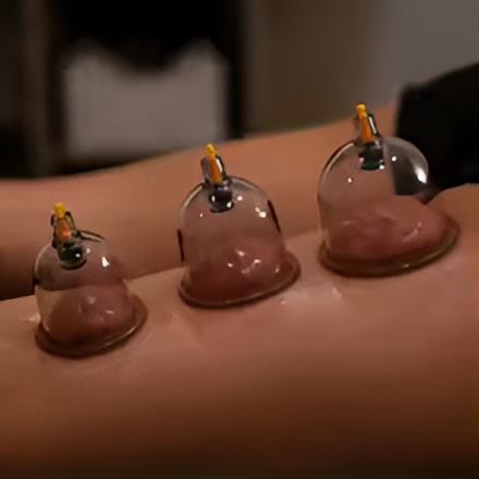 f104178487ac741987201bc98bed3f72 10-Piece Hijama Cupping Therapy Set – Vacuum Suction Massage Cups with Pull-Out Pump | Pain Relief, Blood Circulation, R - Image 4