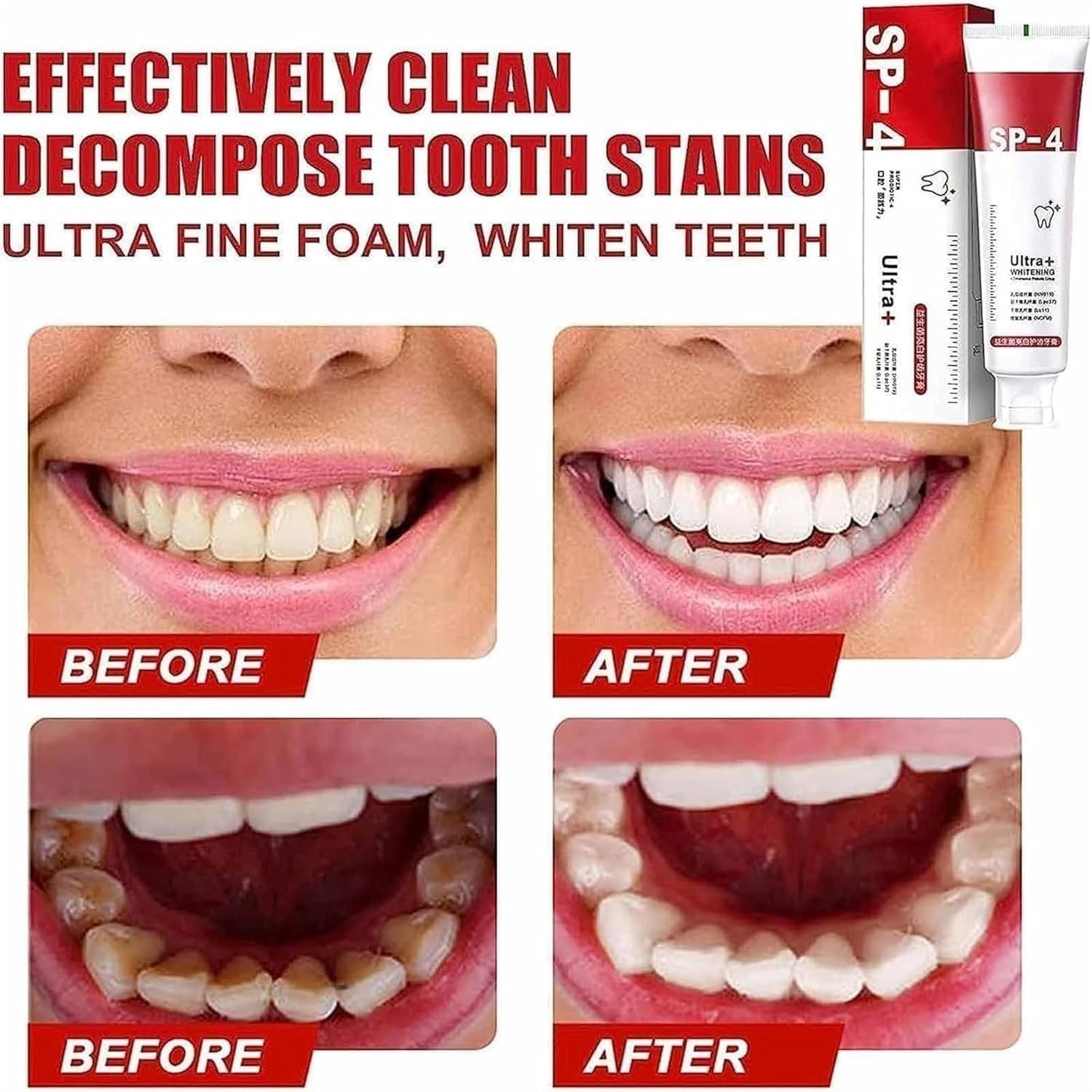 f2f183ce2387da3274be6dad6f66a860 Yayashi Sp 4 Ultra Whitening Toothpaste Strong Stain Removal Fresh Breath Daily Oral Care - 120g - Image 2