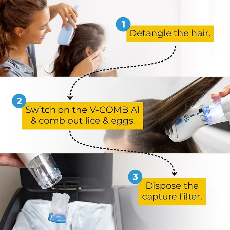 f7478bb5fcb09e9c3309ef4e8d3300b8 LICETEC V-COMB Electric Head Lice Remover | Chemical-Free Treatment | Vacuum & Comb System to Remove Lice and Nits for A - Image 2