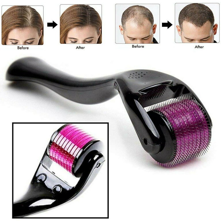 fcde476d597dfb8113cb6b08ce4a5cbb Derma Roller 0.5mm Micro Needle for Skin Care, Hair Growth, Acne Scars & Anti-Aging - Image 4