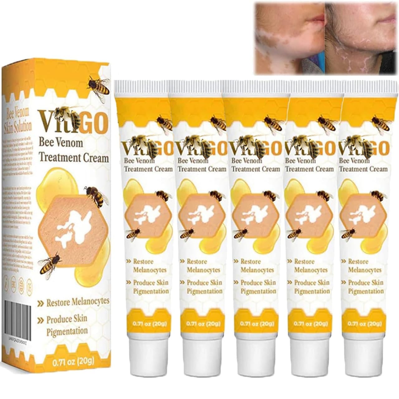 feca295995eee425ac6f403c771ab062 Fivfivgo™ VitiGO Bee Venom Correcting Cream (20g) – Advanced Melanocyte Support for Skin Pigmentation Recovery and Even - Image 3