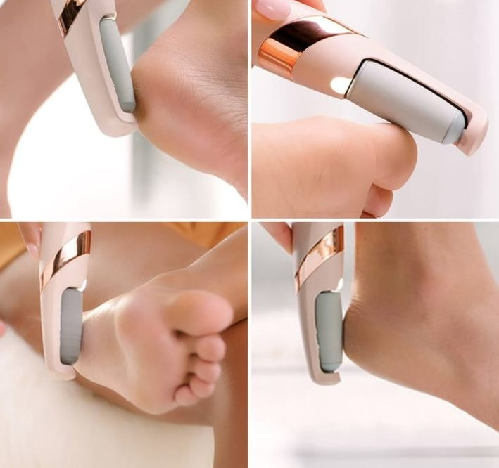 imgi_76_54b2f820a65683aa6b2df7eab7230492-1 Rechargeable Electric Pedi Foot Filer – Effective Callus Remover for Soft, Smooth Feet - Image 4