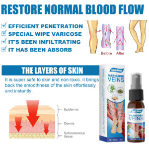 30ml Varicose Veins Treatment Spray Varicose Vein Treatment Cream Repair Varicocele Removal Pain Relief Kidney Inflammat