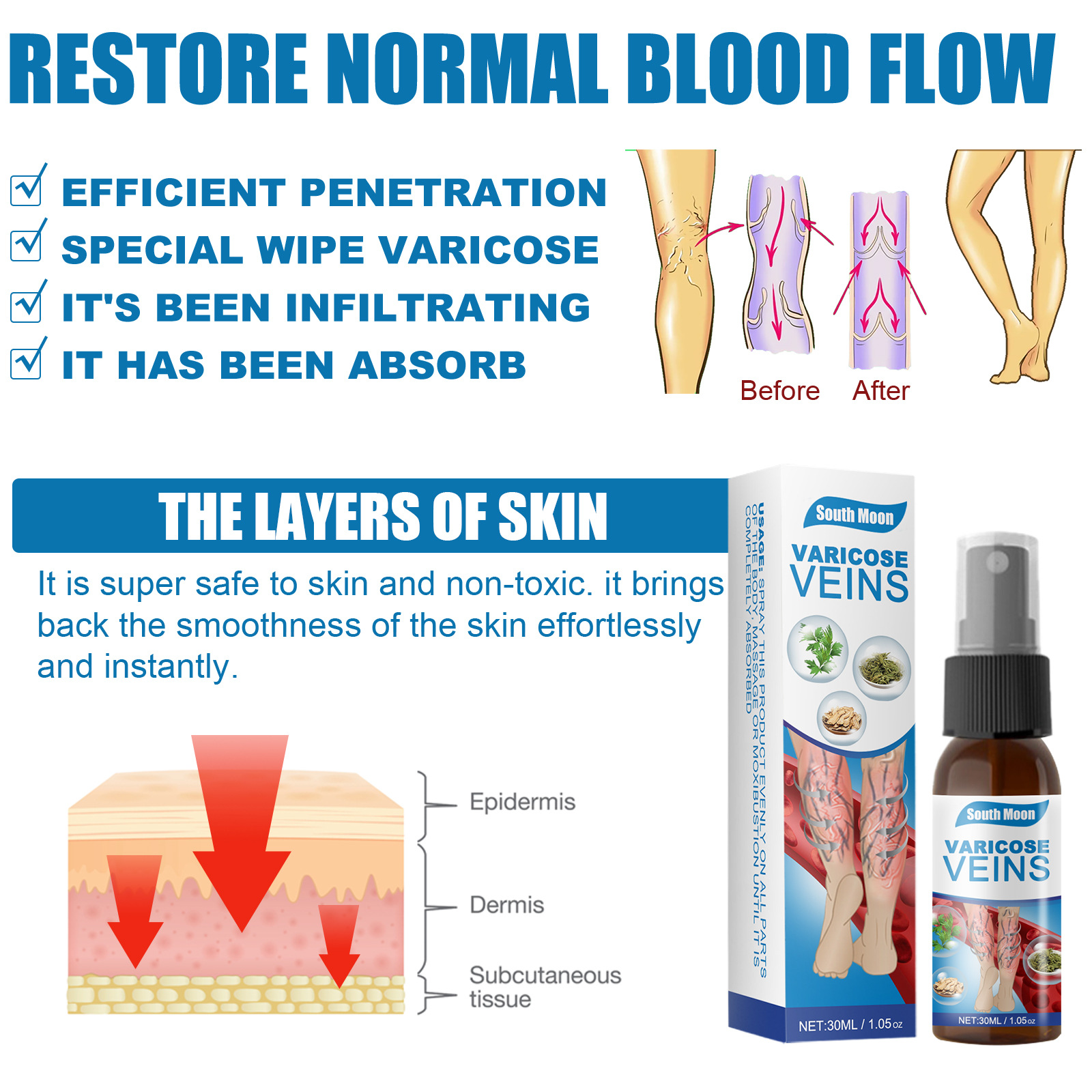 30ml Varicose Veins Treatment Spray Varicose Vein Treatment Cream Repair Varicocele Removal Pain Relief Kidney Inflammat