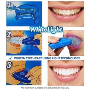 White Light Teeth Whitening Brightener | No box card packing and cell operated.