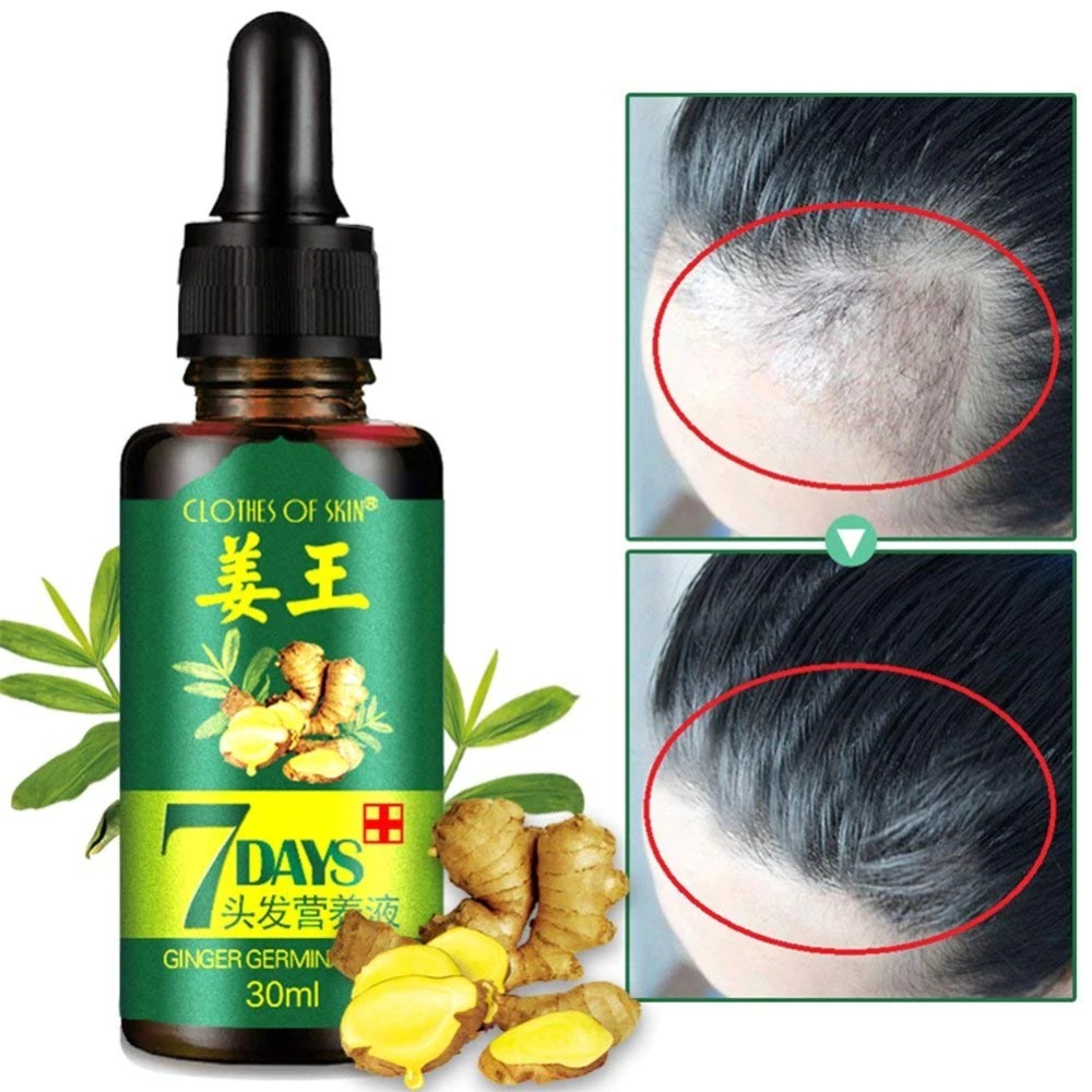 7 Day Ginger Germinal Oil Hair Nutrient Solution Hair Growth Essence Liquid Fast Natural Hair Loss Treatment Hair Care (