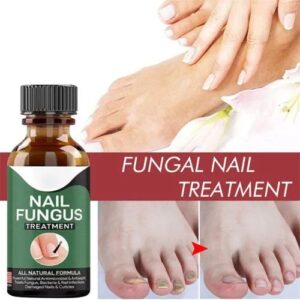 Fast Nail Fungal Treatments Nail Repair Essences Serum Care Treatments Foot Nail Fungus Removal Gel Paronychia Onychomyc