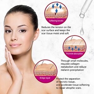 AICHUN BEAUTY Scar Removal Facial Serum Pimples Stretch Marks Face Moisturizing Body Remove Scars Kojic Acid Vitamin E 3