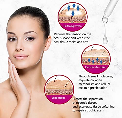 AICHUN BEAUTY Scar Removal Facial Serum Pimples Stretch Marks Face Moisturizing Body Remove Scars Kojic Acid Vitamin E 3
